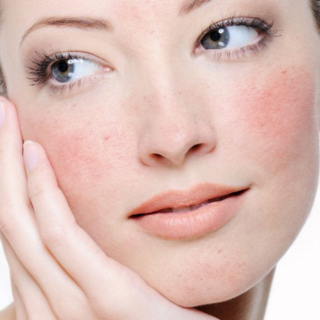 SENSITIVE SKIN