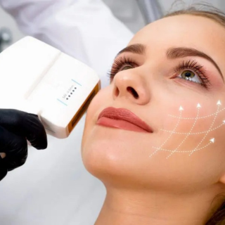 HIFU facial