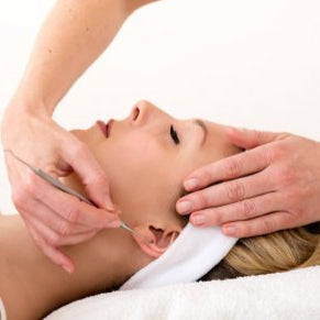 Acupuncture in Nerja