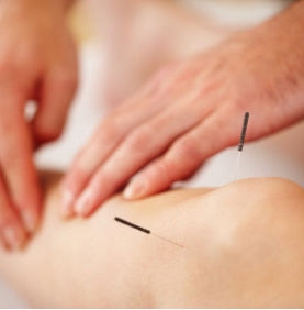 Acupuncture in Nerja
