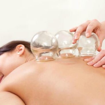Cupping