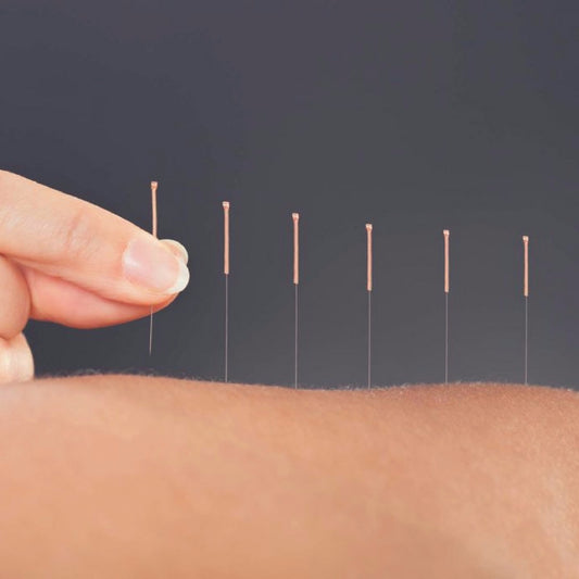 Accupuncute treatment in Nerja